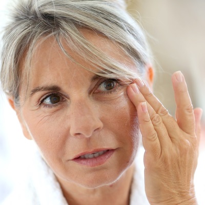 skin pigmentation treatments at Springs Salon in Warrington, Cheshire